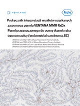 Roche BenchMark ULTRA Interpretation Guide